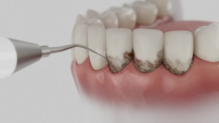 Trusted Dental Crowns And Bridges service in Vinton, IA - Dentist Open Now